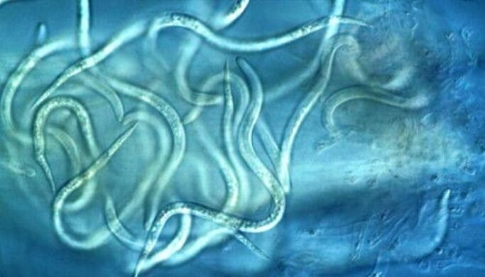 nematod parazitleri insan vücudunda neye benziyor