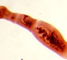 Ekinococozis